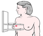 ilustrovani pregled dojke